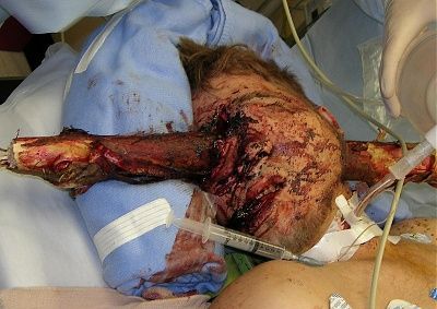 man-takes-tree-branch-through-face-ouch.jpg