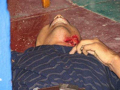 what-happened-his-neck-528425.jpg
