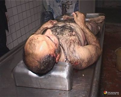 dead-ossetian-soldier-prepared-autopsy-1213270767_still0611_00000-1.jpg
