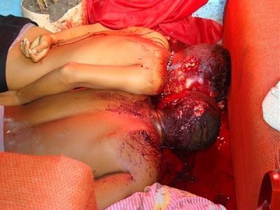 double-homicide-two-teenagers-shot-11.jpg