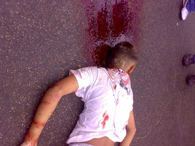 Gory Pictures and Video