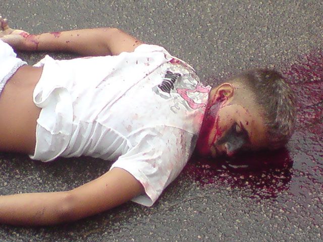 Gory Pictures and Video