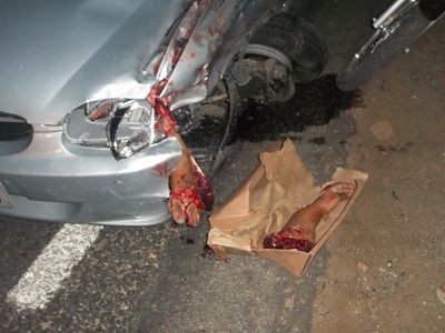 severed-20arm-20and-20foot.jpg