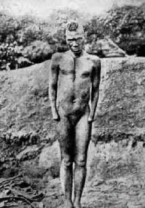 castrated men pictures