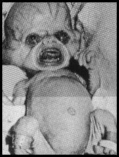 crack-baby-humansdeformitiesimage10.jpg