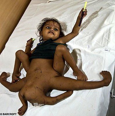spider-girl-vishnu-before01.jpg
