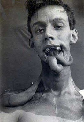 lip-deformity-sook13.jpg
