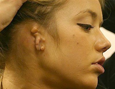 sasha-gardner-ear-deformity-wilson_sasha_gardner3_071217_ssh.jpg