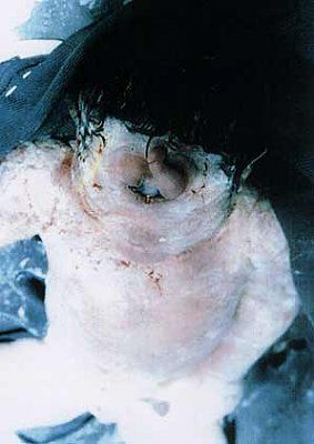 deformity-face-image001.jpg