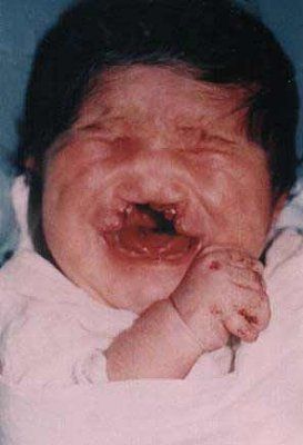 severe-malformation-face-image021.jpg