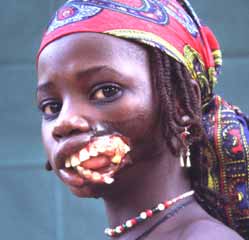 noma-disfigurement-facingafrica-girlwithnoma-1.jpg