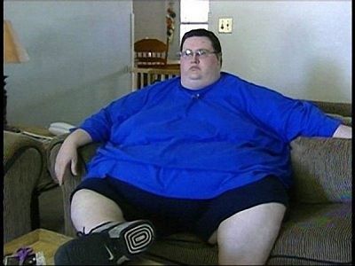 gastric-bypass-before-after-pictures-gastric-bypass-pictures-1.jpg
