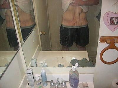 gastric-bypass-before-after-pictures-gastric-bypass-pictures-8.jpg