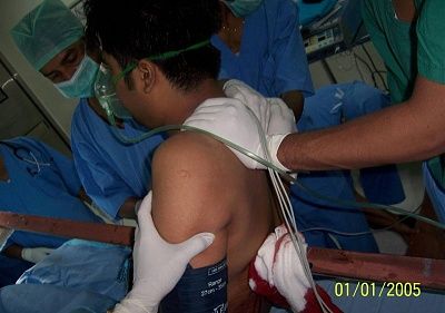 man-empaled-metal-sign-pole-picture2.jpg