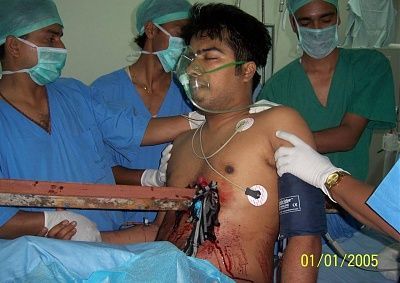 man-empaled-metal-sign-pole-picture3.jpg