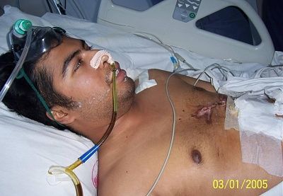 man-empaled-metal-sign-pole-picture13.jpg