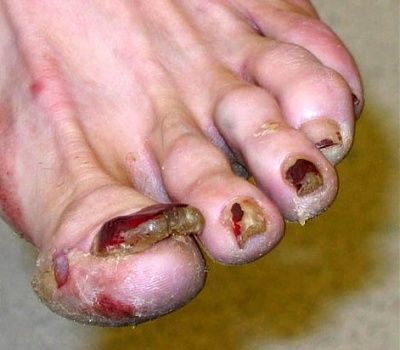 ok-who-has-foot-fetish-a7bfccd255fa.jpg