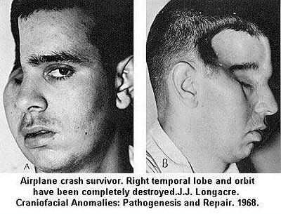 airplane-crash-survivor-crash.jpg