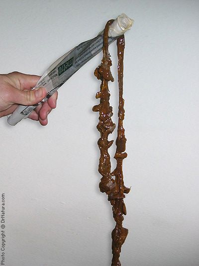 colon_cleanse_lg100.jpg ...