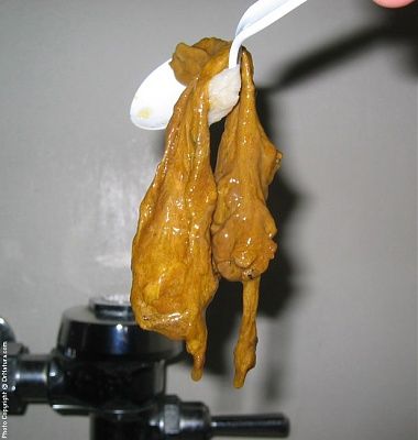colon-cleansing-aftermath-colon_cleanse_lg115.jpg