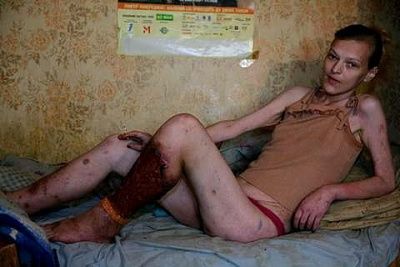russian-heroin-addicts-drags_ua_02.jpg