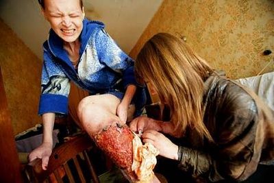 pictures-russian-heroin-addicts-drags_ua_03.jpg
