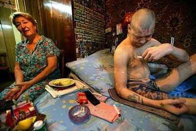 pictures-russian-heroin-addicts-drags_ua_07.jpg