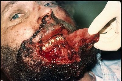 lip-torn-apart-8f4p2c0.jpg