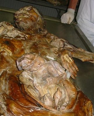 mummified-mother-unborn-child-1.jpg