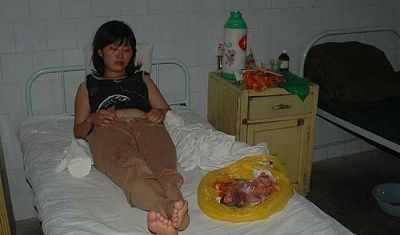 forced-abortion-china-doctors-place-baby-bag-next-her-abortion-bag1.jpg