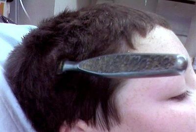 butter-knife-pulled-boys-head-2mry64n.jpg