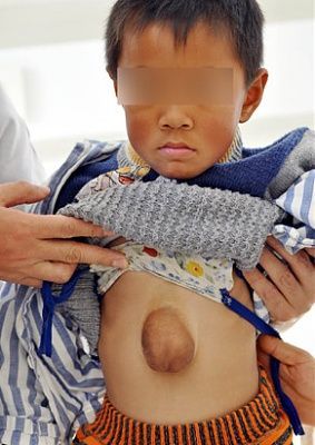 four-year-old-zhang-weiyuan-china-ap_zhang_weiyuang_081124_ssv.jpg