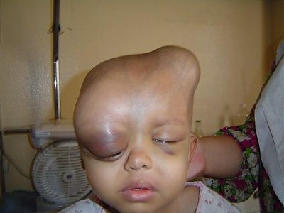 weird-head-weird-head.jpg