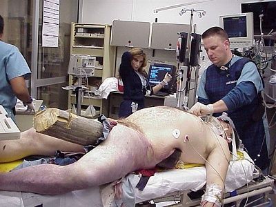 ouch-big-wood-thingy-guy-ouuuuccchh-.jpg