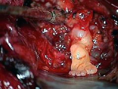 foot-found-newborns-brain-footinbrain.jpg
