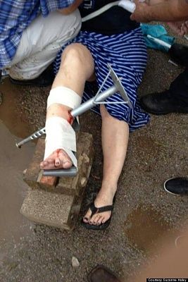 o-suzanne-haley-impaled-570.jpg