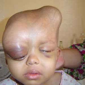 children-effected-depleted-uranium-depleted_uranium_effects.jpg