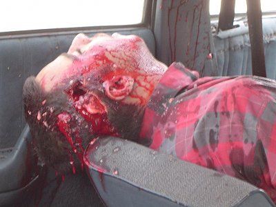 two-gunshot-wounds-head-iraq-orig_dsc00113a_526.jpg