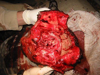 iraqi-soldier-killed-action-orig_img_2215_511.jpg