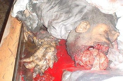 death-sheikh-ahmed-ismail-yassin-hamas-founder-7.jpg