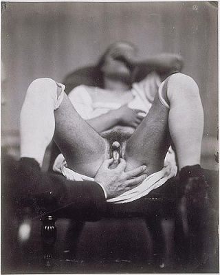 nadar-2cexamination-20of-20a-20hermaphrodite-2cc.1860.jpg