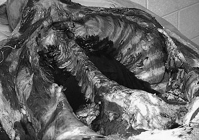 interiorautopsy.jpg