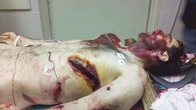 dead-terrorist-tamerlan-tsarnaev.jpg