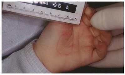 jonben-t-ramsey-autopsy-photos-handclear.jpg