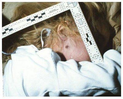 jonben-t-ramsey-autopsy-photos-00jonbenetfaceruler5.jpg