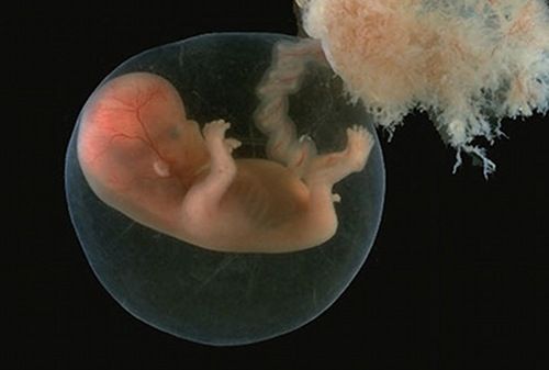 Developing Embryo S From Start To 40 Weeks