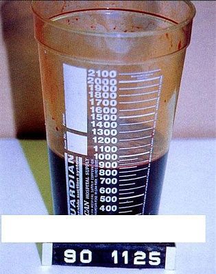 viraldeathdrugs4.jpg