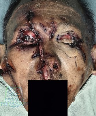 _005-dr.jpg