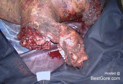 car-accident-victim-02-500x340.jpg