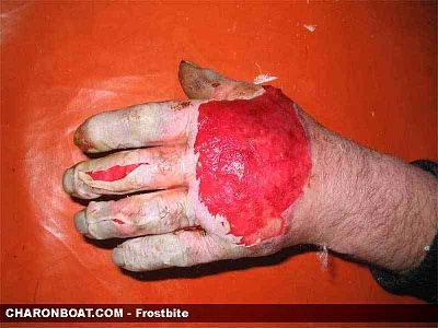 charonboat_dot_com_frostbite_1.jpg